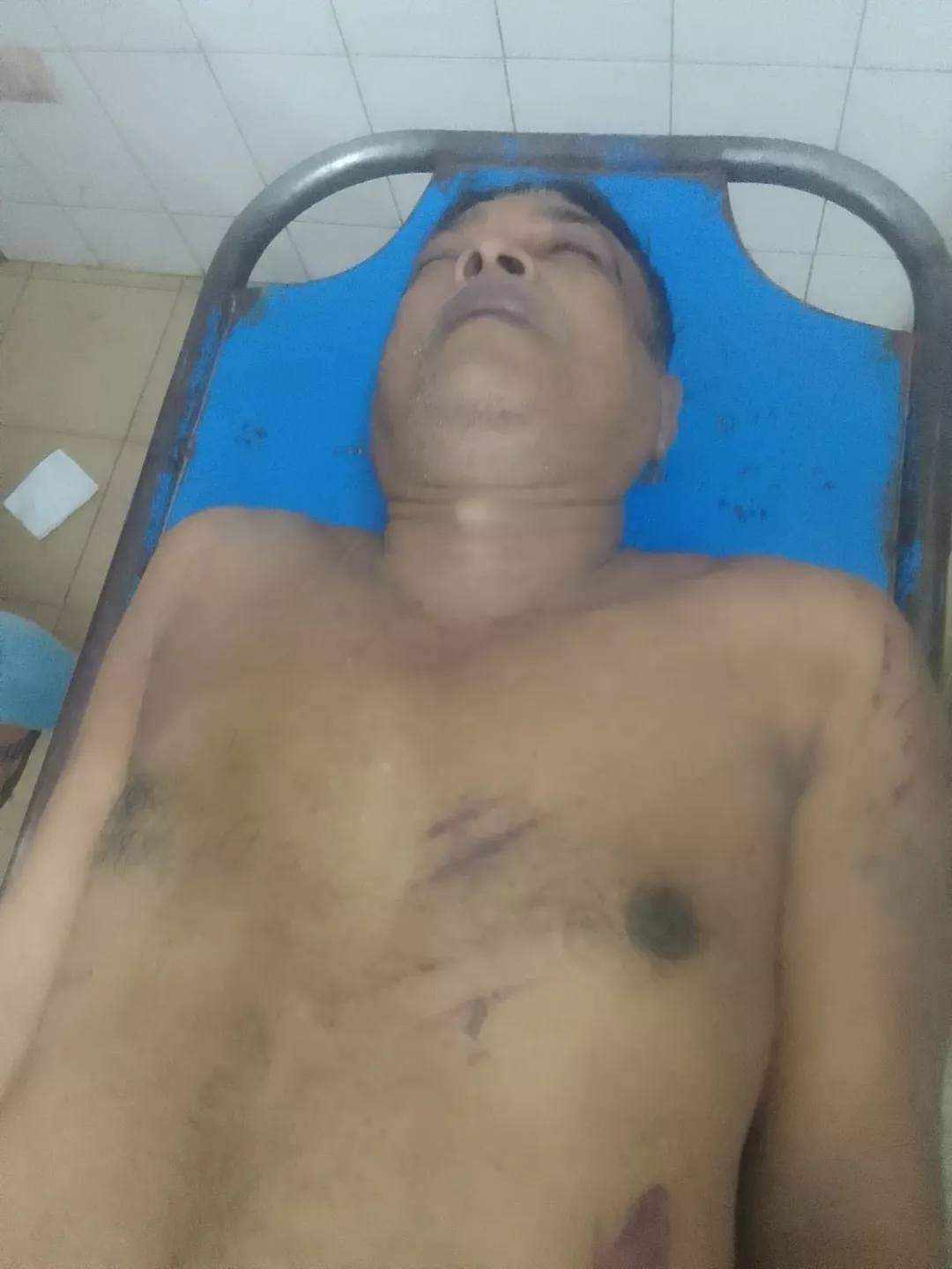 লক্ষ্মীপুরে নুর আলম নামের এক আওয়ামীলীগ নেতাকে পিটিয়ে হত্যা