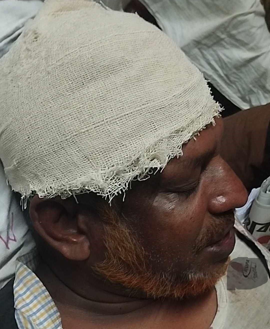 লক্ষ্মীপুরে সাংবাদিকদের উপর স্বশস্ত্র হামলা ও গুলি ৪ সাংবাদিক আহত