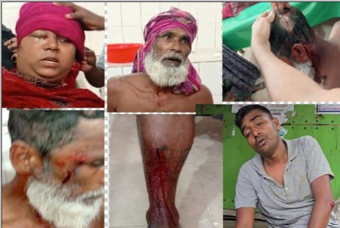বাউফলে দুই গ্রুপের সংঘর্ষে সেনা সদস্য সহ আহত-১৪